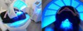 FOTOTERAPIA CON LUZ LED